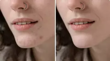retusz twarzy przed i po